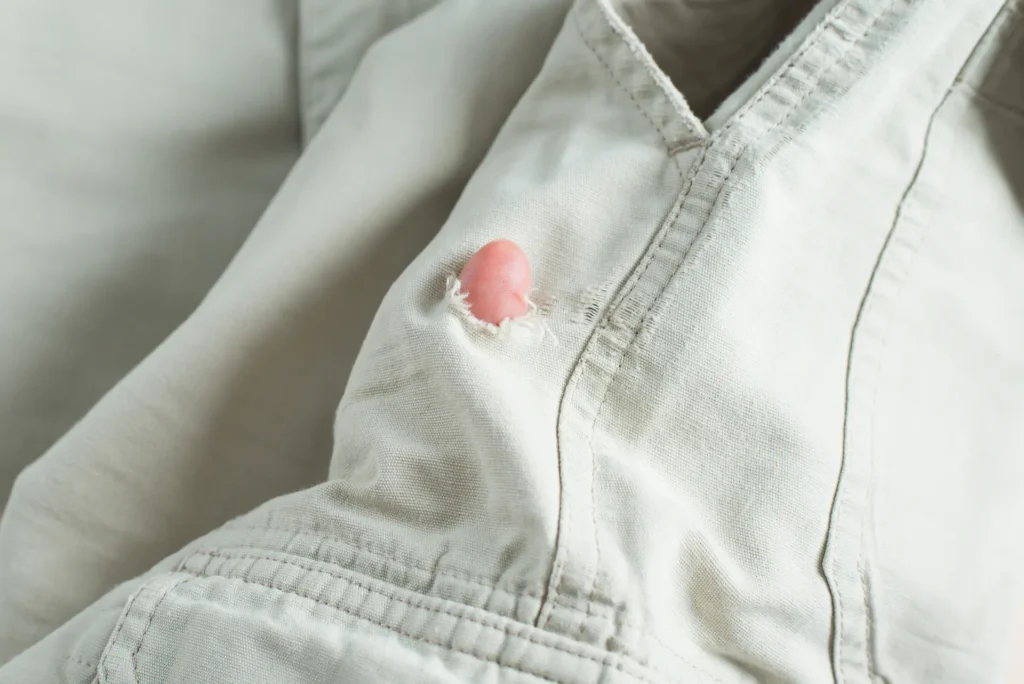 Common Problems Invisible Mending Can Fix